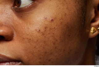  HD Face skin Calneshia Mason cheek pores skin texture 0004.jpg